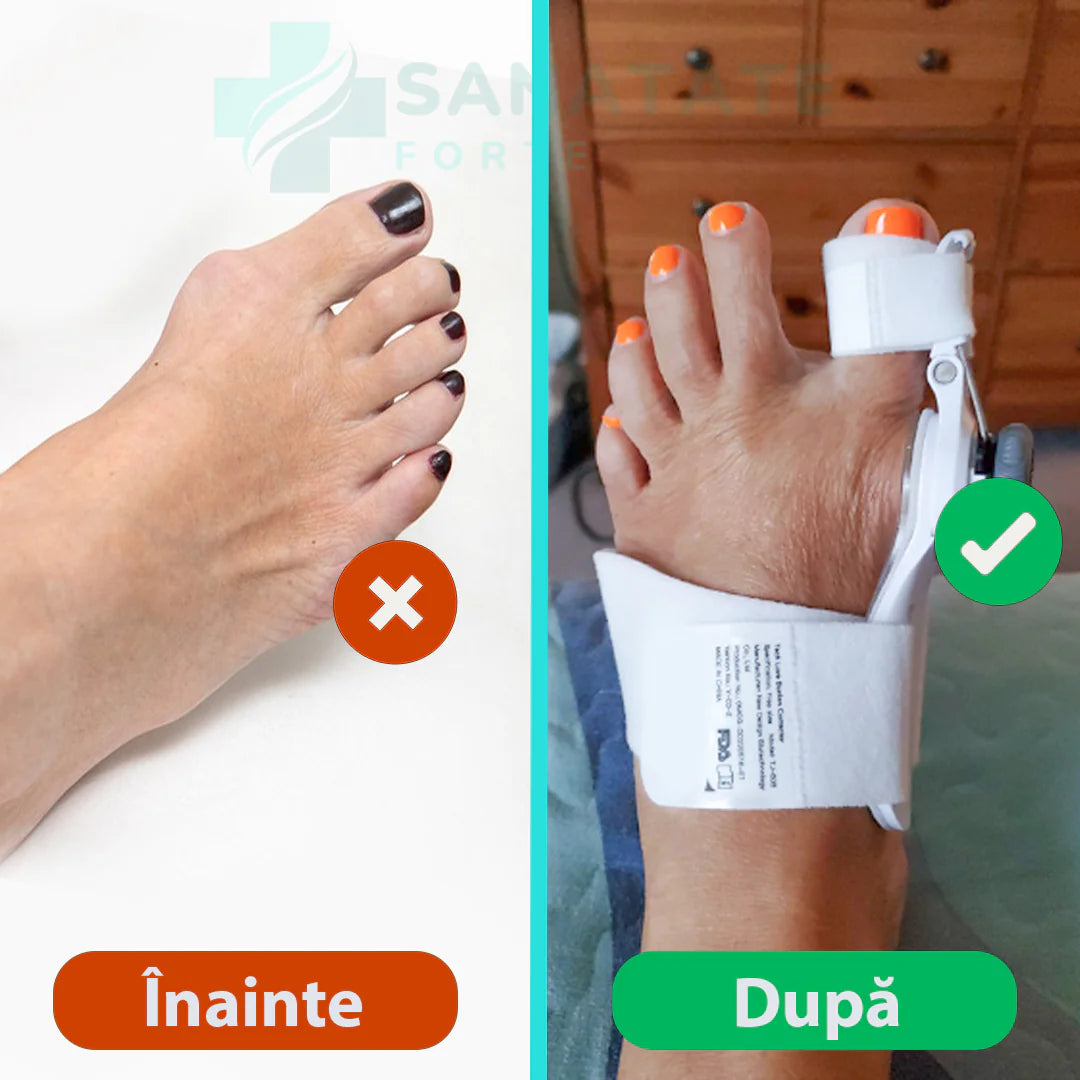 Corector de Monturi — MontFix™️