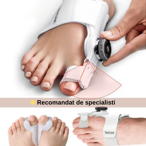 Corector de Monturi — MontFix™️