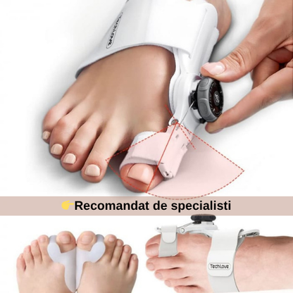 Corector de Monturi — MontFix™️