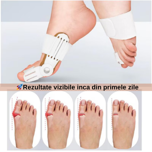 Corector de Monturi — MontFix™️